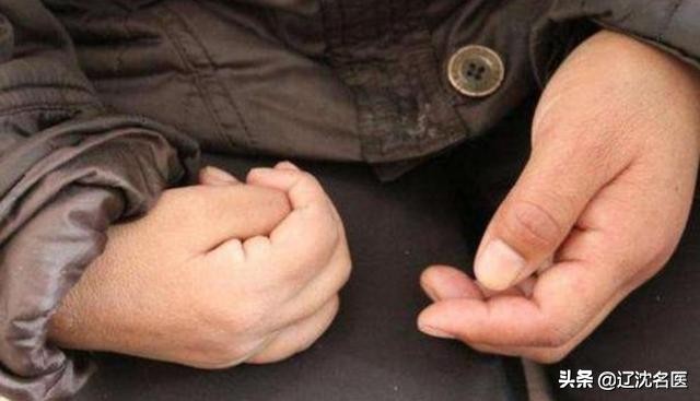 沈阳医大二院手足外科专家,沈阳现代医院治疗偏瘫