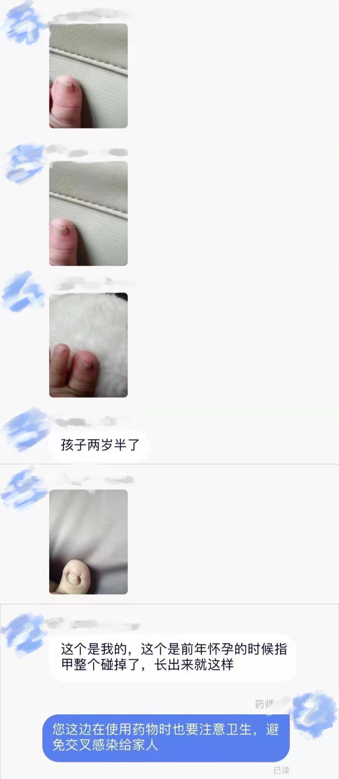 心疼宝宝怎么办,心疼孩子脚指甲