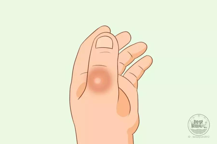 一岁宝宝总吃手怎么戒掉,2岁孩子吃手严重怎么戒掉