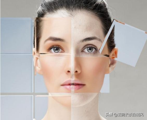 长了老年斑有什么办法可以解决,突然长很多老年斑怎么消除