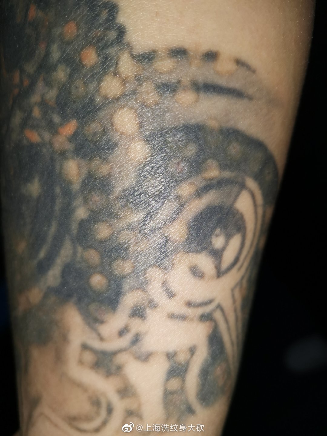 洗纹身药水真的能洗纹身吗,目前最好的洗纹身方法