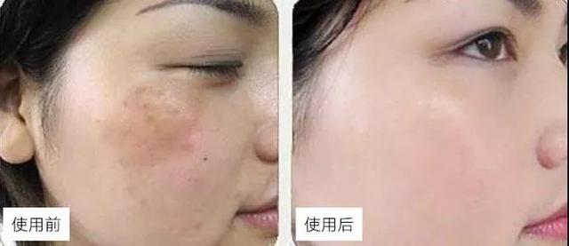 药店那些不起眼的国货护肤品,药店便宜好用的软膏