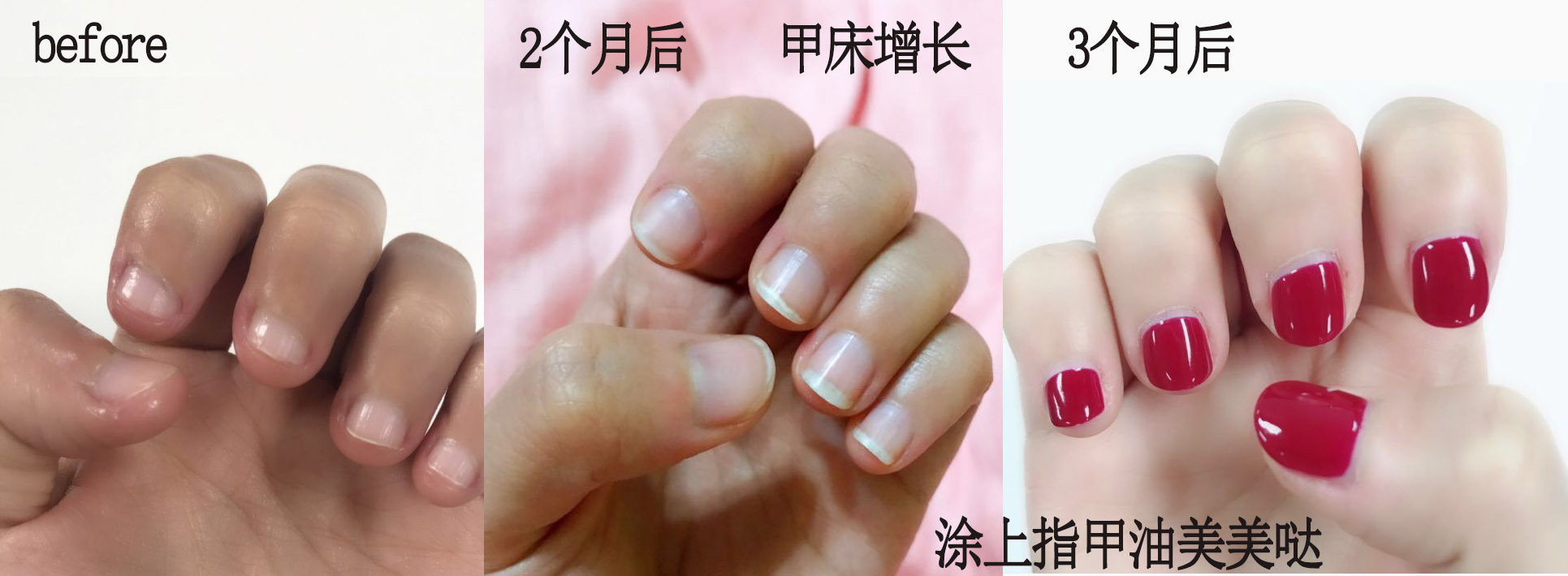 易劈易断还分层？美国专业沙龙修复甲油，给“病甲”快速“整容”