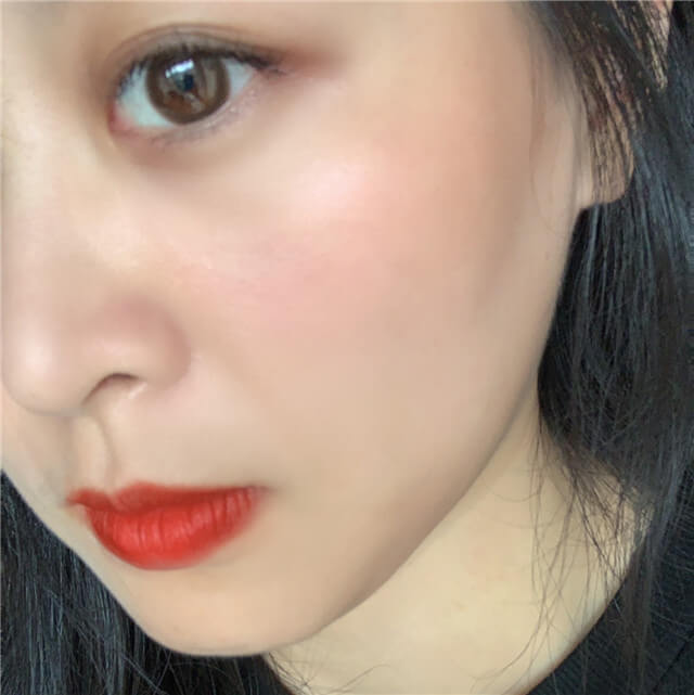 油性皮肤如何祛痘,油性皮肤怎么祛痘痘效果好