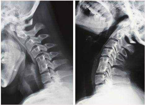 俯卧撑怎么发力手腕不受伤,俯卧撑手腕伤了怎么治