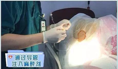 怕疼？让生娃像打针一样无痛的黑科技，国外80%已普及！还观望吗