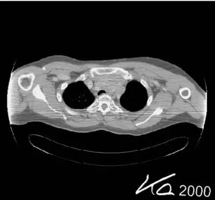 ct图像解析大全,ct图像与实物大小对比