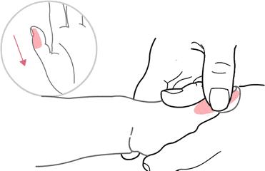 小儿推拿治疗宝宝脾胃疾病,值得收藏