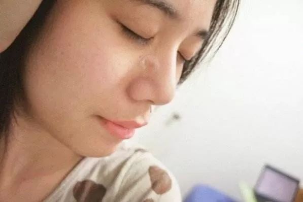 有效祛痘印的痘痘贴,祛痘痘的药膏明星