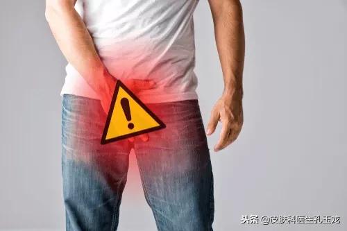 皮肤科医生股癣怎么治疗,皮肤科常见疾病