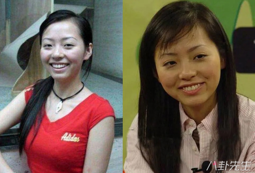 各届超女整容,2015年超女整容失败新闻案例