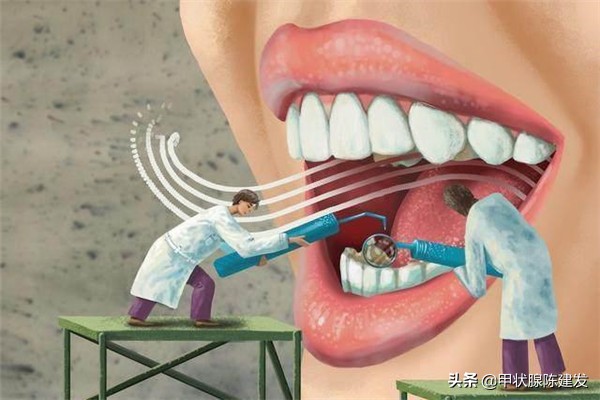 咽炎怎么治疗预防,咽炎最佳治疗方法和禁忌