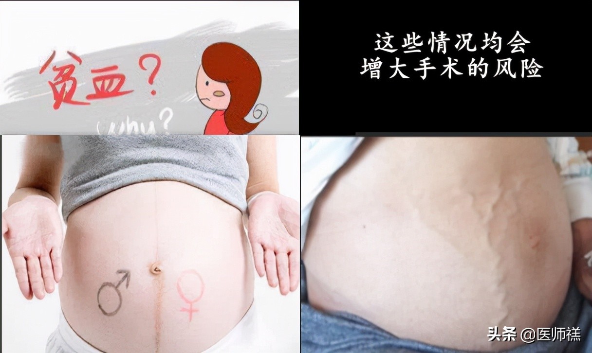 肝囊肿穿刺和微创切除哪个风险大,肝脏穿刺风险和后遗症