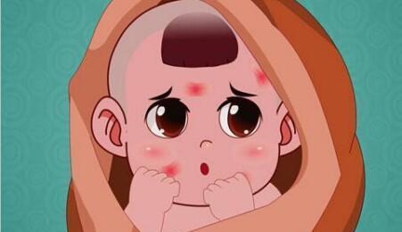 一个月宝宝得了血管瘤怎么办,宝宝身上有血管瘤怎么办