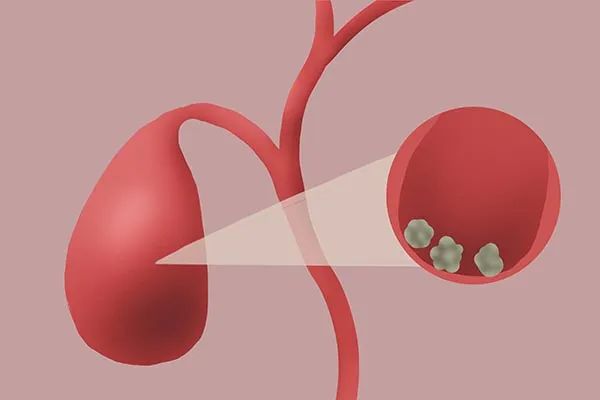 饿真的能治百病吗,饿有益健康吗