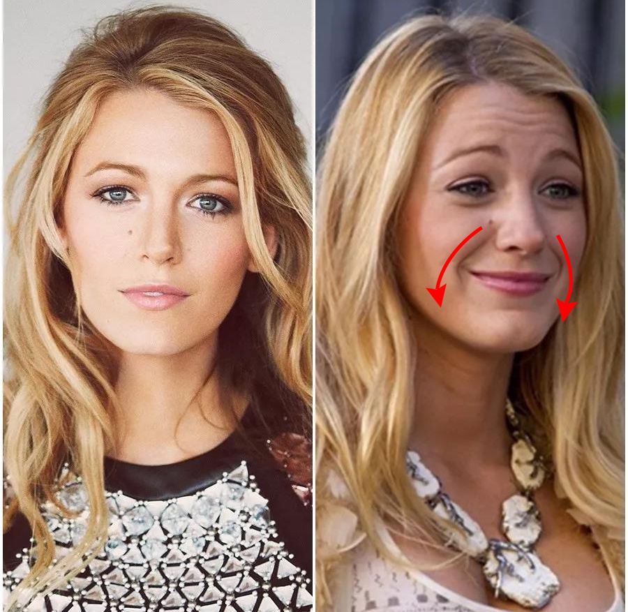 改善眼角细纹的方法有哪些,眼角皱纹细纹怎么去掉