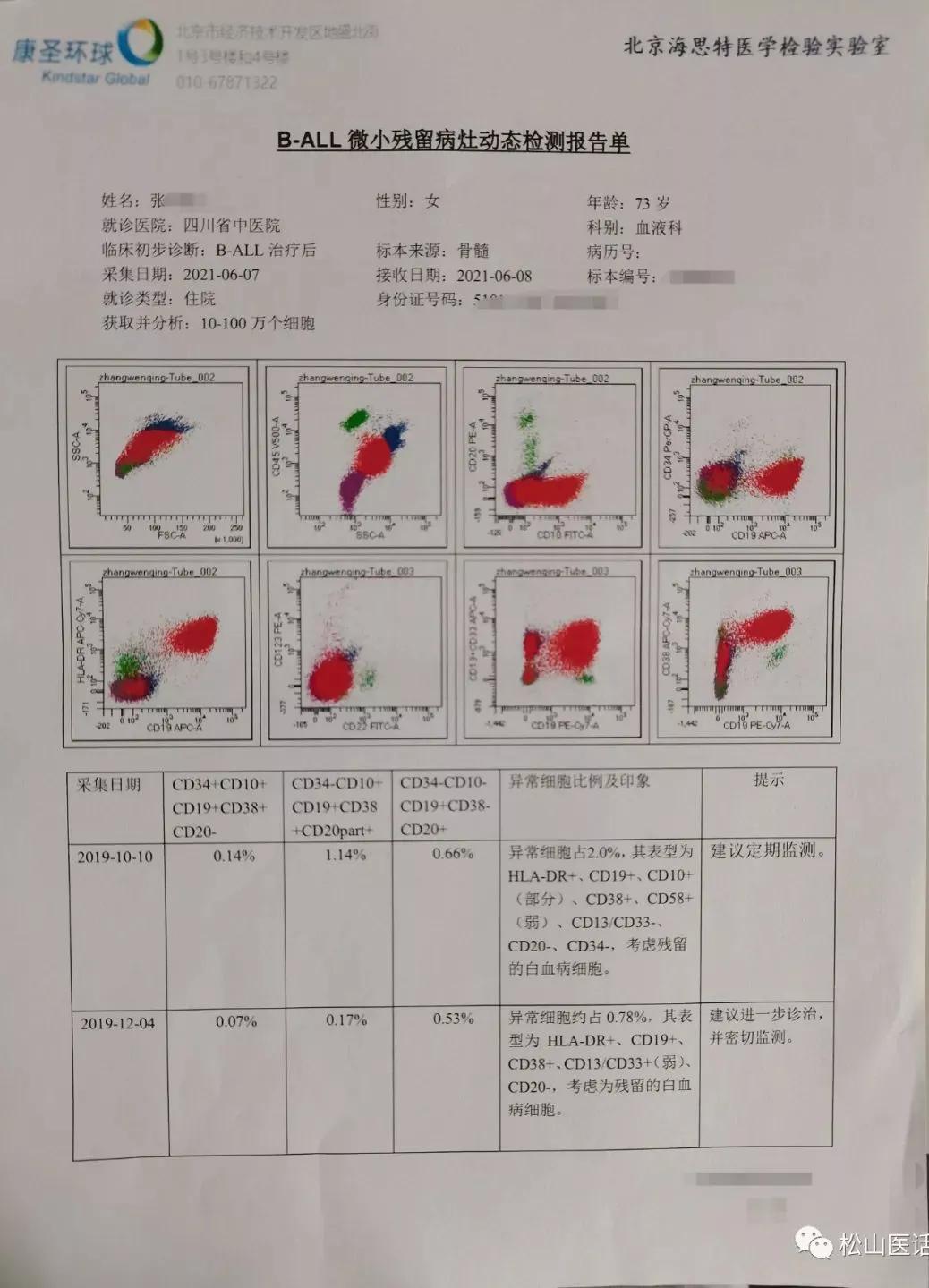 松山医话刘松山教授,松山医生看骨髓增殖性肿瘤怎么样