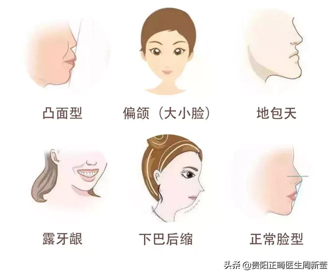 牙齿不好怪父母,儿童口腔不良习惯及矫正