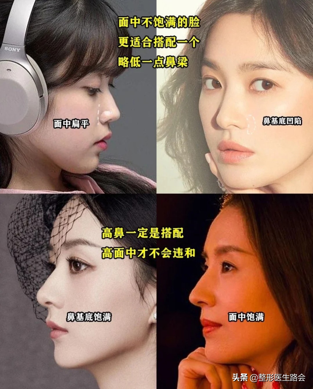 直鼻微翘怎么整,直鼻微翘怎么做出来自然又好看