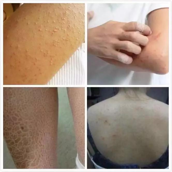 保湿的身体乳公认最好用,抹了身体乳皮肤干燥起皮