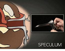 只有你才能真的保护好你自己，别耽误了检查