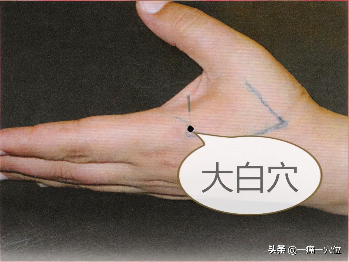 头部怕风吹是什么原因,头部怕吹风什么原因