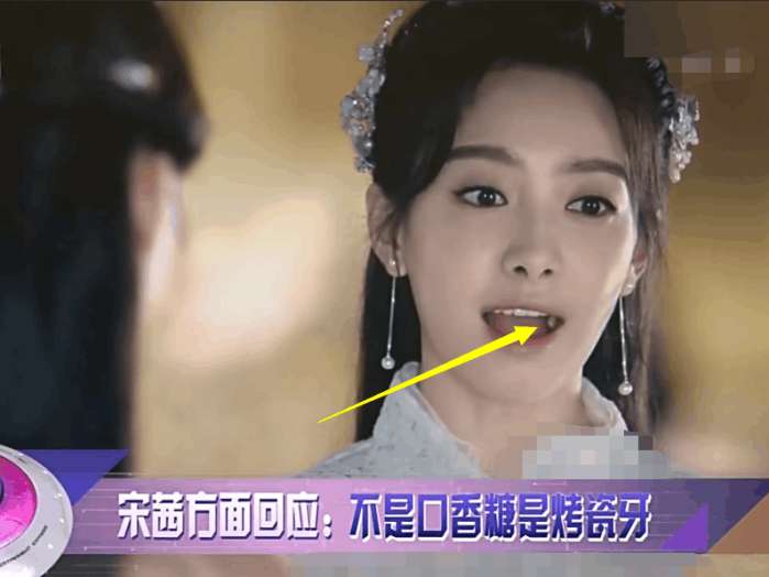 明星做烤瓷牙会做根管治疗吗,烤瓷牙的明星