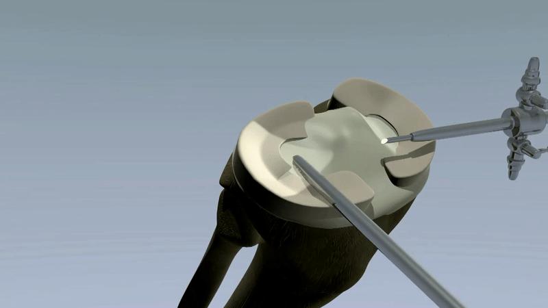 热爱舞蹈的老阿姨,热爱跳舞的阿姨