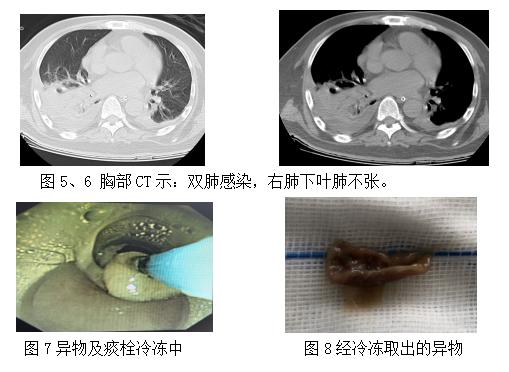 三亚人民医院呼吸内科在几楼,海南省人民医院呼吸内科