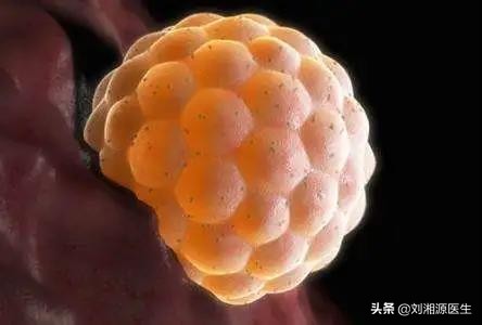 免疫相关不良妊娠诊断指南,免疫治疗不良妊娠的方法