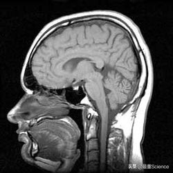 世界最强的医用核磁共振仪,快速磁共振成像mri技术问世