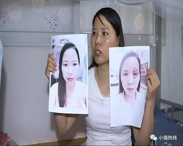 我没整容之前漂亮的要死,我没整容之前都好看得要死