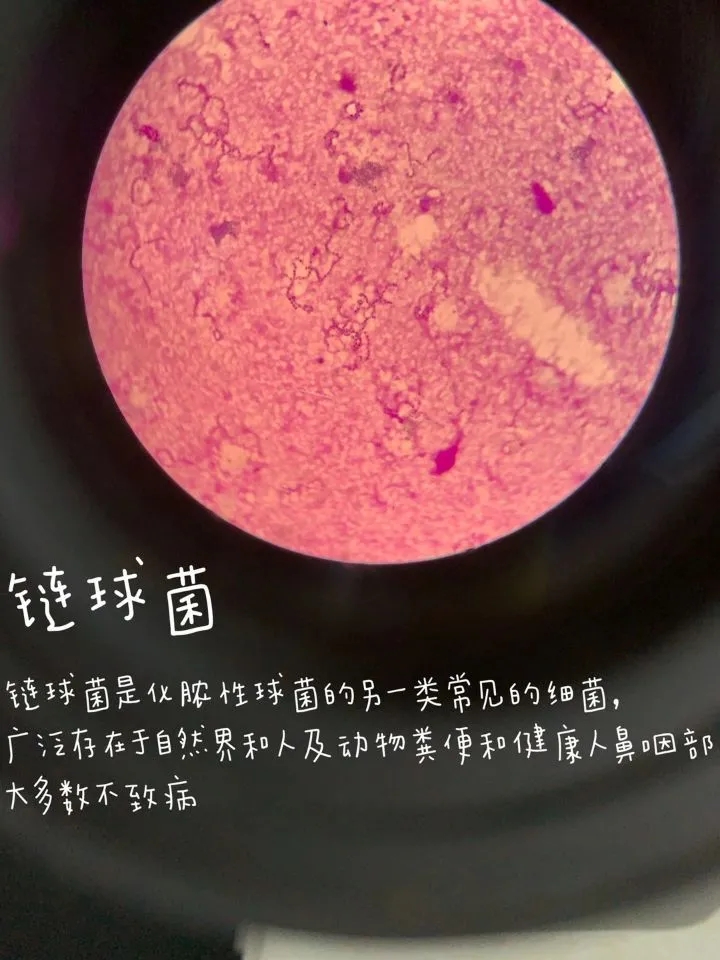 医学生学习打卡做题,医学生学习成果检验视频