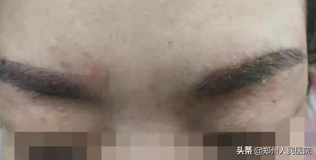 纹个眉会倒霉多久,纹眉属于破相吗