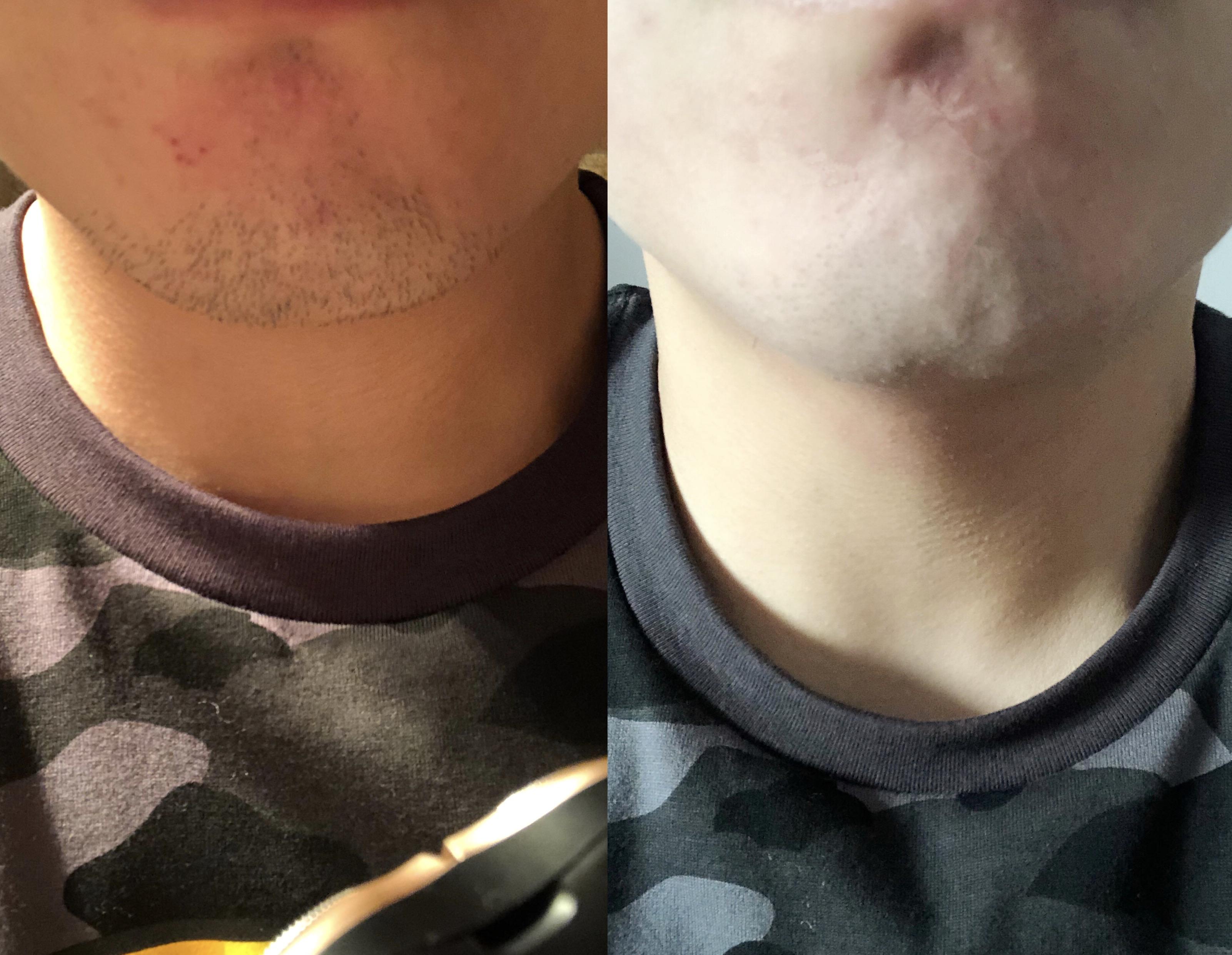 素士凌朗s3剃须刀使用体验如何,素士凌朗s3剃须刀怎么用