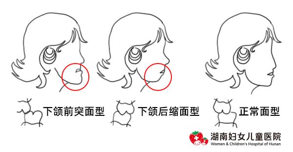 教你如何防止孩子啃指甲,孩子啃指甲特别严重怎么办