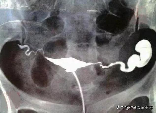 助孕专家于萍,青岛医生于萍视频