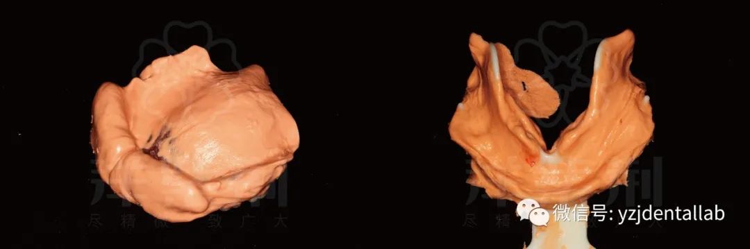 病例教学视频,病例分析操作技能