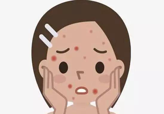 避免痘痘的四个误区,只需四个步骤解决痘痘问题