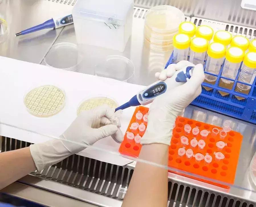 医学检验尿液相关知识,医学验尿是检查什么