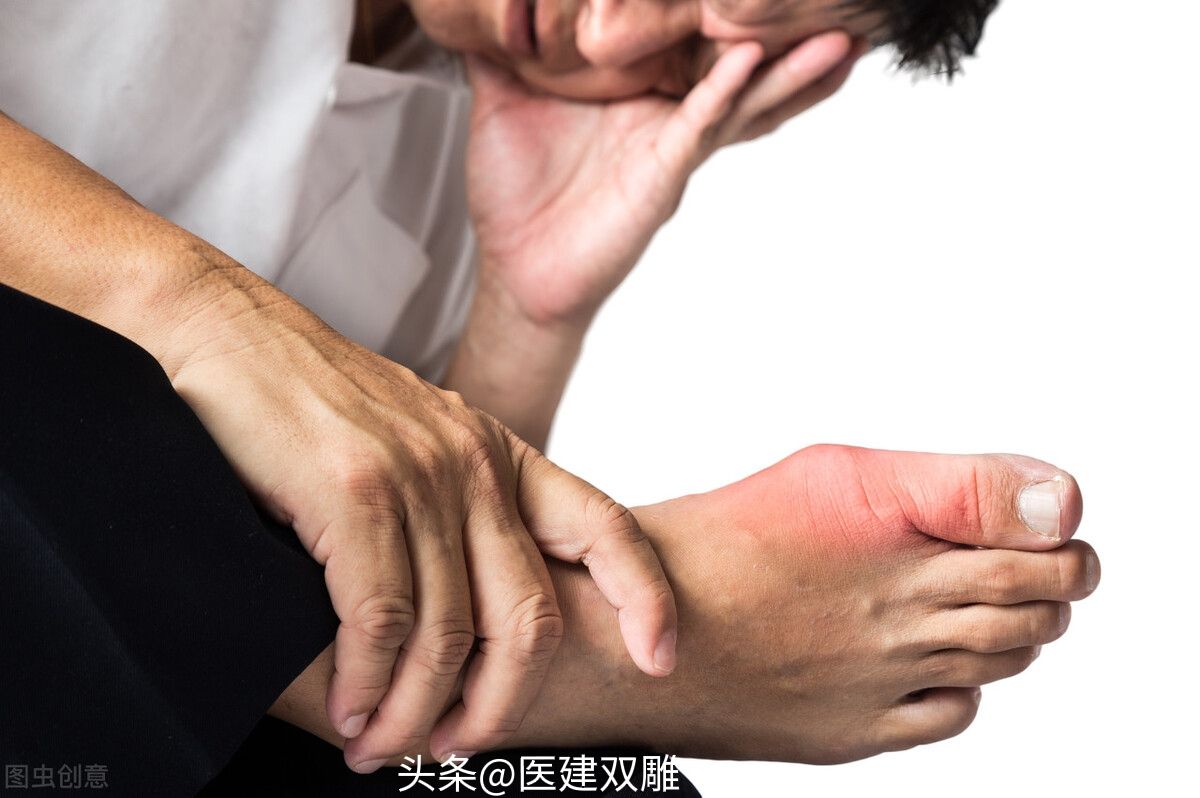 都说非布司他副作用少，要不要长期服用？医生详解