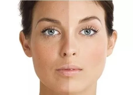 片仔癀护肤品去斑有效吗,片仔癀的护肤品祛斑吗