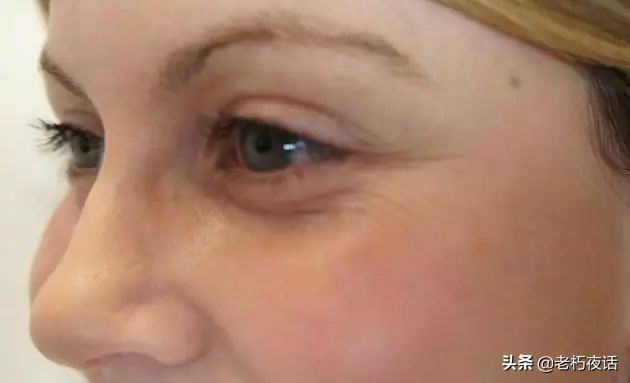 海藻眼贴淡化细纹眼袋,淡化细纹眼袋暗沉面膜