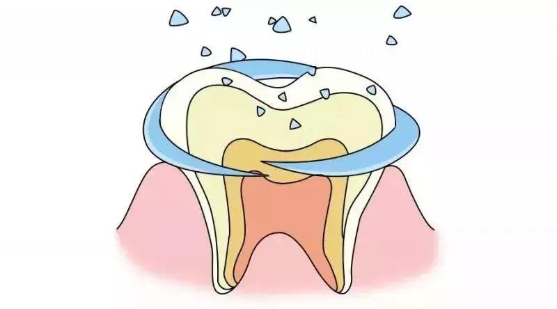 小朋友虫牙补了就好了吗,小孩的虫牙需要治疗吗