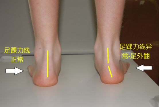 跑鞋鞋子尺码怎么选才最合适,选鞋指南跑鞋尺码