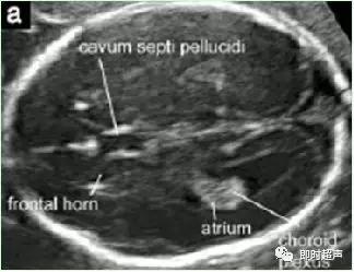 产科常规彩色超声报告单介绍,常见妇科疾病超声报告