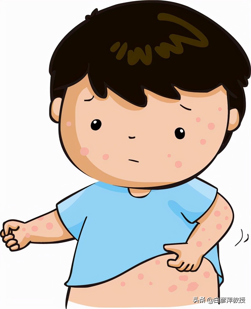 红疹与麻疹的区别,红疹与风团的区别