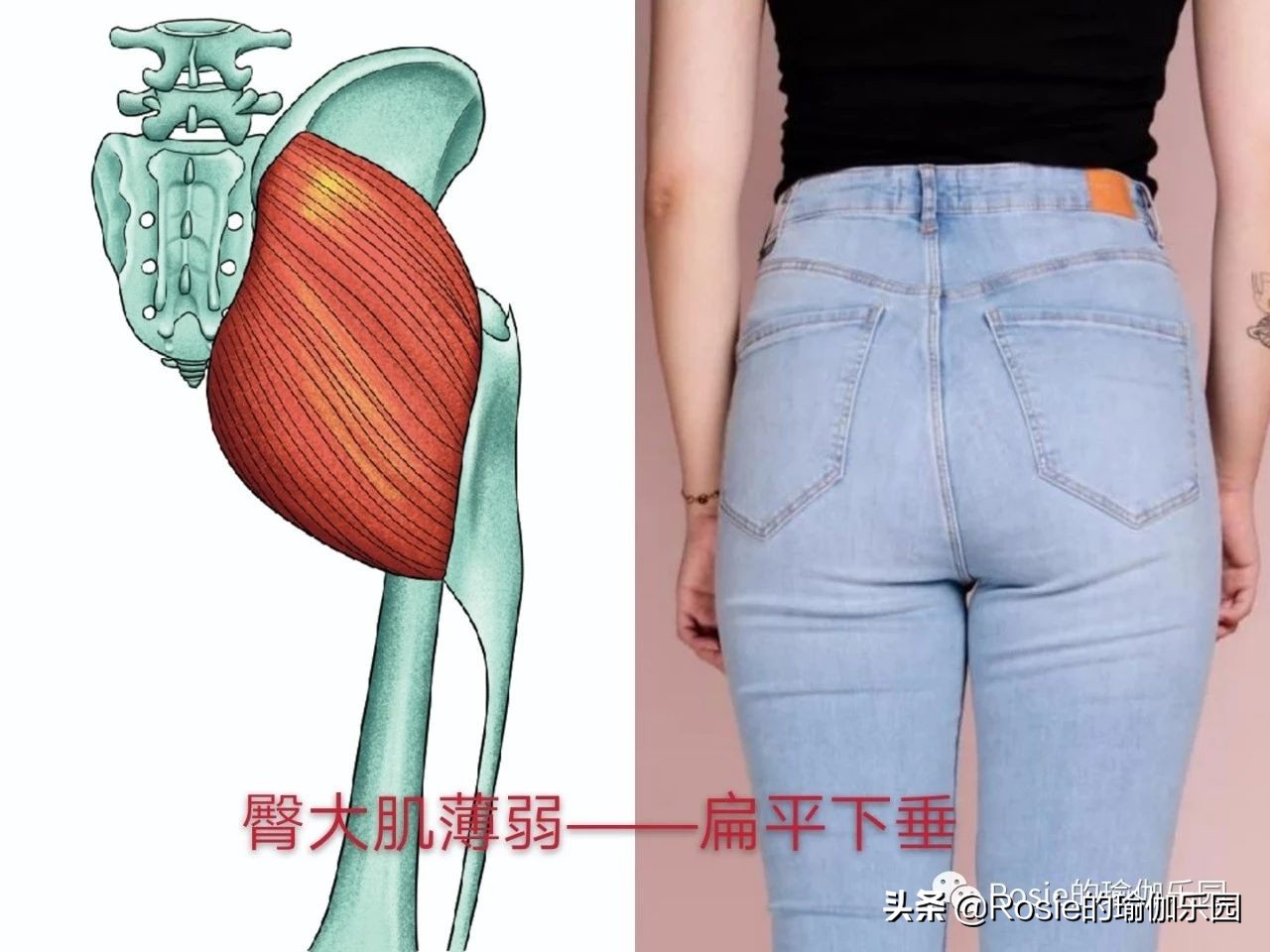 如何知道是真翘臀还是假翘臀,真翘臀和假翘臀是怎么判断的