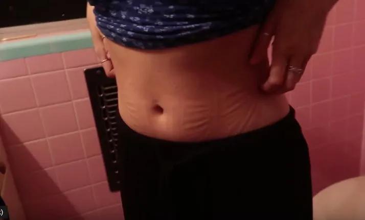 “内脏下垂、子宫脱落、漏尿……”：扒一扒你不知道的网红束腰