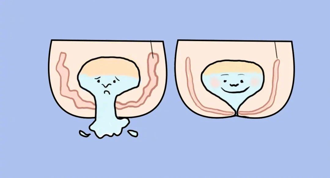 普拉提恢复盆底肌需要多久,居家普拉提练盆底肌修复动作